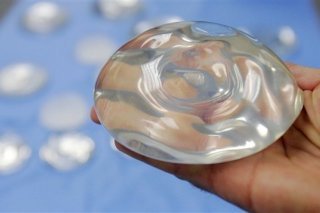 110614_3v8ig_implants-mammaires_sn635