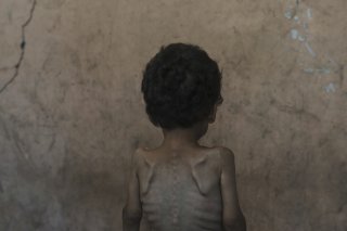 "Les dernières données indiquent que les seuils de famine ont été atteints dans la majeure partie de la bande de Gaza", indique le rapport IPC. Les hôpitaux signalent une augmentation rapide des morts de faim chez les enfants de moins de 5 ans, avec au moins 16 décès signalés depuis le 17 juillet. KEYSTONE/AP/Jehad Alshrafi