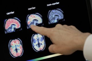 La société vaudoise AC Immune doit couper dans ses effectifs (photo d'illustration). KEYSTONE/AP/MATT YORK