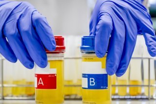 Un collaborateur du LAD, le Laboratoire suisse d'Analyse du Dopage, analyse des echantillons A et B contenant de l'urine dans le laboratoire antidopage KEYSTONE/JEAN-CHRISTOPHE BOTT