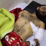 Un homme blessé dans les heurts entre Alaouites et contre-manifestants à l'hôpital. KEYSTONE/AP/Omar Albam