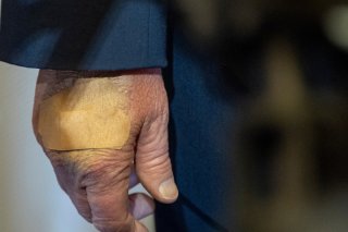 Le dos de la main droite de Donald Trump est régulièrement maquillé ou pansé pour cacher des bleus (archives). KEYSTONE/AP/ALEX BRANDON