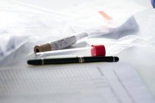 Plus de 7,5 millions de tests de dépistage du coronavirus ont été réalisés en Suisse depuis le début de la pandémie (archives).