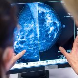 Selon les dernières statistiques suisses, un homme sur deux et une
femme sur trois sont confrontés à un cancer au cours de leur vie